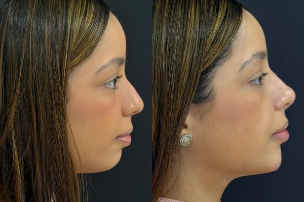 555393266_18534308920012912_1783670719123907398_n